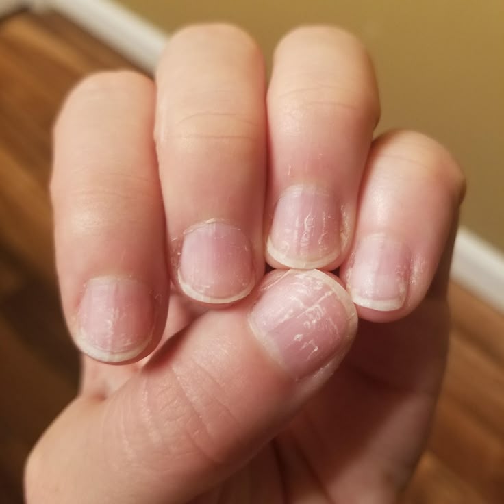 Nail Cuticle Oil Pen — KEvea.™