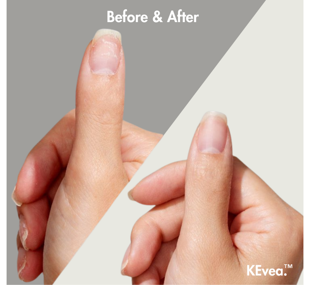 Nail Cuticle Oil Pen — KEvea.™